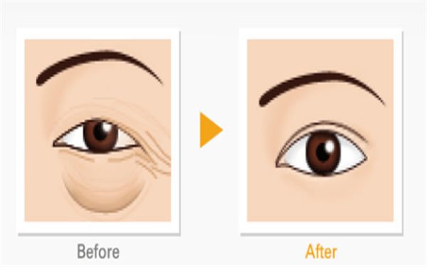 哈爾濱隆胸修復(fù)醫(yī)院排名及口碑對(duì)比，哪家專業(yè)又靠譜？