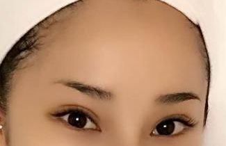 合肥哪家醫(yī)院臉部激光治療效果好，值得推薦？