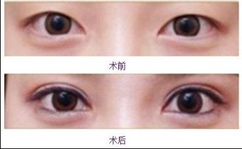 合肥美白針哪家醫(yī)院好？排名前幾位的合肥專業(yè)美膚診所推薦