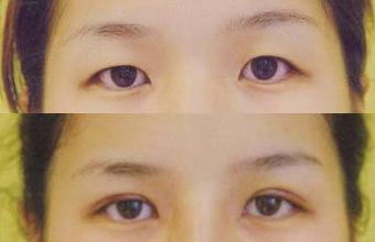 大慶微整形醫(yī)院哪家好？頂級專家為您解讀微整形醫(yī)院選擇指南！