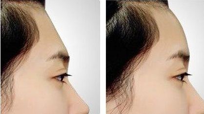 珠海市哪家整形醫(yī)院口碑好？專業(yè)整形醫(yī)院推薦排行揭曉