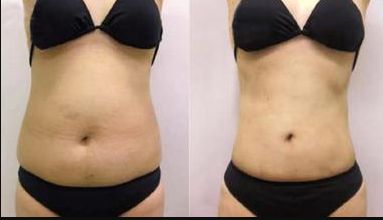 太原哪家醫(yī)院眼袋整形好？?jī)?yōu)質(zhì)專家推薦