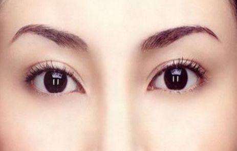 中國哪家假體隆胸醫(yī)院好？2023排名TOP10及專家推薦