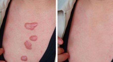 鄭州市哪家美容醫(yī)院好？優(yōu)質(zhì)專業(yè)醫(yī)療服務等你來咨詢！