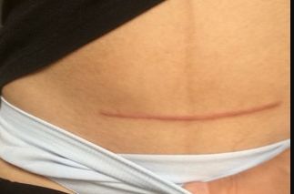 如何選擇新疆做胎記醫(yī)院，哪家好？