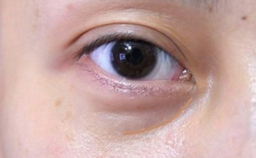 邯鄲哪家醫(yī)院做私密整形好？解析當代女性美容訴求