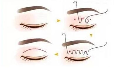 南寧夢(mèng)想醫(yī)療美容門(mén)診部的項(xiàng)目有哪些值得了解的特色？