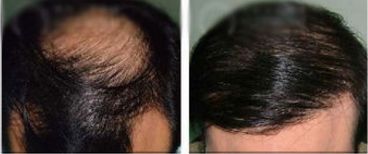 寧波哪家醫(yī)院割雙眼皮效果好、經(jīng)驗豐富，值得推薦？