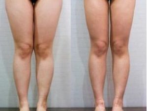 南京眼皮松弛醫(yī)院排名及口碑調查：哪家醫(yī)院是患者首選？