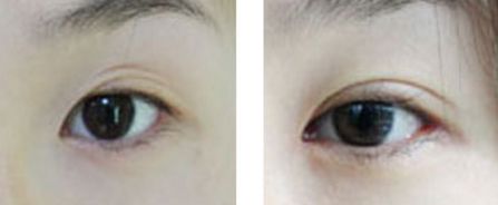 汕頭市整形醫(yī)院有哪些？哪家整形醫(yī)院在汕頭市口碑好？