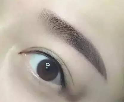 佰華利董萍的面部脂肪填充經(jīng)驗(yàn)，展現(xiàn)自然少女感