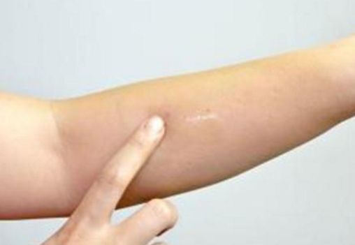 蘇州吸脂瘦身醫(yī)院哪家好？選個(gè)最適合你的專業(yè)醫(yī)療機(jī)構(gòu)