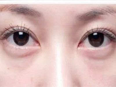 寧波祛斑哪家醫(yī)院好？精選寧波祛斑專業(yè)醫(yī)院推薦！