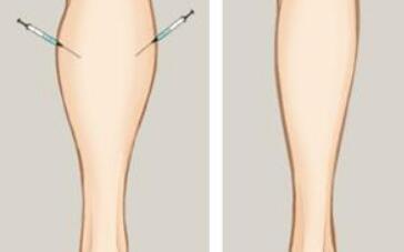上海第九人民醫(yī)院美容外科專家介紹：劉菲、蘇薇潔領(lǐng)軍，醫(yī)術(shù)出眾！