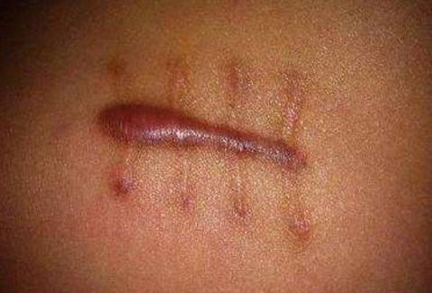 貴陽胎記治療醫(yī)院的名氣有哪些？