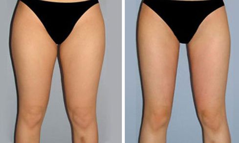 重慶美萊整形美容醫(yī)院口碑如何？醫(yī)生名單和特色項(xiàng)目都有什么？