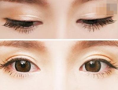 西寧豐胸整形醫(yī)院排名前三，專業(yè)醫(yī)生推薦！