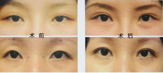 揭秘佛山哪家整形醫(yī)院吸脂好？導醫(yī)全解析、患者口碑高，信賴度高！