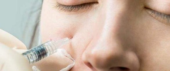 西安哪家醫(yī)院激光去斑效果最好？