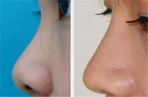 2023柳州背部激光溶脂排行榜10強醫(yī)生(龍昕、亓發(fā)芝、湯維華讓你變美更放心，更安全！)