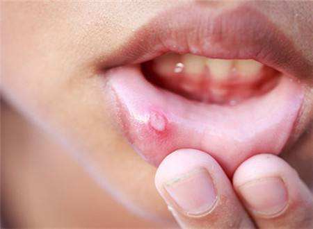 2023杭州注射膠原蛋白隆鼻排名前幾的醫(yī)生(潘虹、吳晶琰、熊麗優(yōu)質(zhì)醫(yī)生任你選擇)