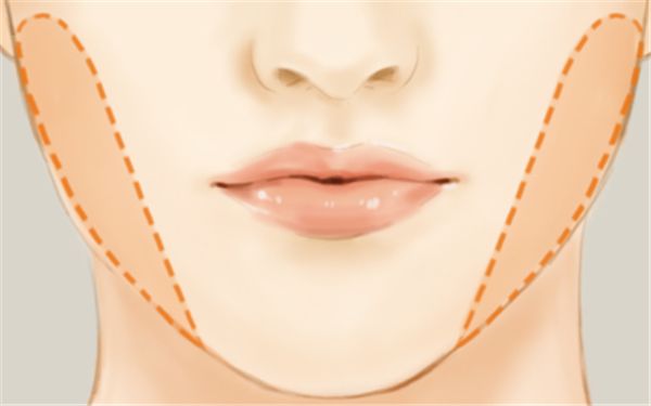 寧波海曙美萊醫(yī)療美容整形醫(yī)院醫(yī)生技術(shù)靠譜嗎？手術(shù)項(xiàng)目有哪些呢？