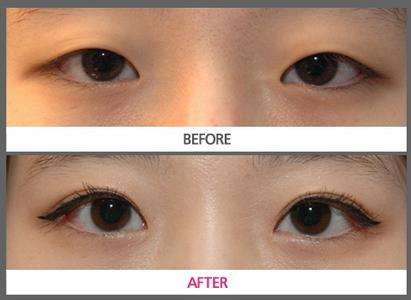 2023臺州吸脂溶脂權(quán)威醫(yī)生口碑前十名(陳巍、崔義澤、成浩口碑優(yōu)異！速看！)