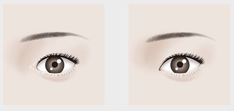 北京整形三甲醫(yī)院哪家好？優(yōu)秀的北京整形三甲醫(yī)院有哪些？