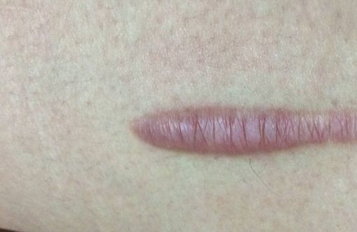 南京有哪些值得推薦的較正規(guī)美容醫(yī)院？