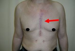 福州果酸換膚哪家醫(yī)院好？