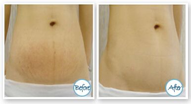 不得不佩服武漢蜜司楊蓉的雙眼皮，簡直完美！讓我們來了解一下醫(yī)院簡介、看看一些案例以及價格的超全信息。