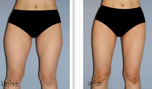 南京哪家醫(yī)院除雀斑好？醫(yī)院雀斑治療排名及效果對比！