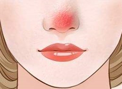 上海九院哪位醫(yī)生做雙眼皮技術(shù)好？?jī)r(jià)格如何？附帶成功案例分析