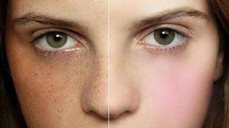 2023青島隆鼻修復(fù)醫(yī)生在榜名單TOP10(于文成、單繼華、任紀(jì)禎哪個技術(shù)OK？)