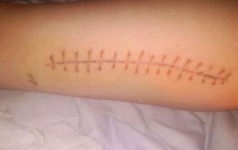 水光針武漢三甲醫(yī)院哪家好？如何選擇適合自己的水光針?lè)?wù)醫(yī)院