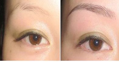 湖北哪家醫(yī)院治療團(tuán)結(jié)口好呢？