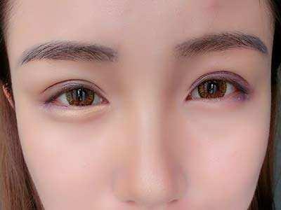 2023合肥魚尾紋專家評價TOP10強(羅定安、劉家賀、朱凡口碑價格出爐)