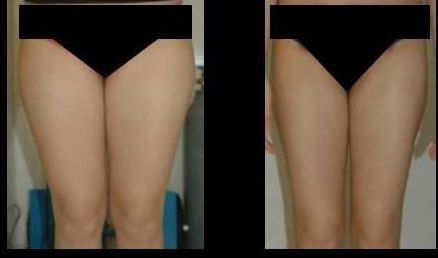 南京做拉皮哪家醫(yī)院好？排名靠前的南京做拉皮醫(yī)院有哪些？