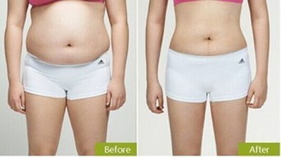 上海美聯(lián)臣整形醫(yī)院蔡豐州最新眼袋整形技術(shù)評測