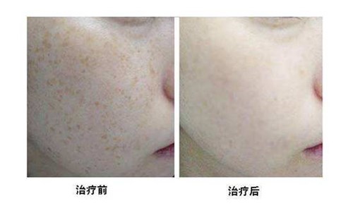 2023西昌專業(yè)腿部吸脂減肥手術(shù)正規(guī)專家口碑前十位(湯穎峰、吳強(qiáng)、劉光毓好評(píng)合集推薦)