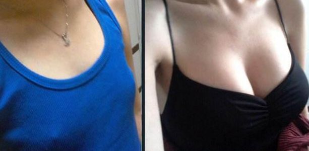 福州鼻梁手術(shù)哪家醫(yī)院好？淺析福州頂級整形醫(yī)院鼻部整形技術(shù)