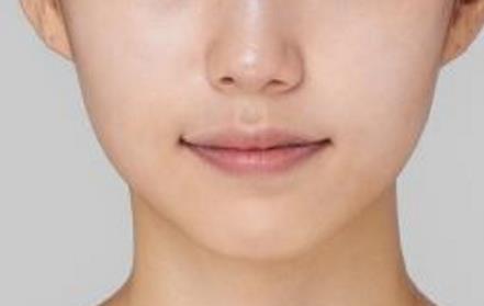 2023承德微雕祛除額頭紋上榜清單前十名醫(yī)生(于學(xué)勇、王銘、孫喜平行業(yè)強中強！)