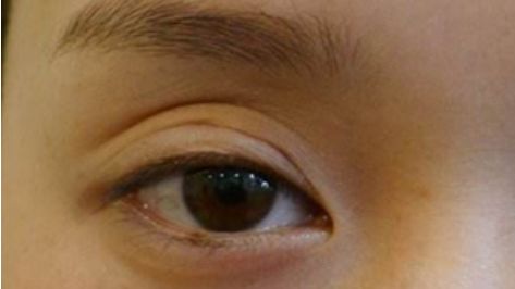 悅美整形醫(yī)院是否是合規(guī)醫(yī)療機(jī)構(gòu)？資質(zhì)概述與名醫(yī)坐診引薦獲取？