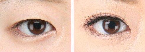 陜西省郴州市有哪些醫(yī)院值得推薦呢？