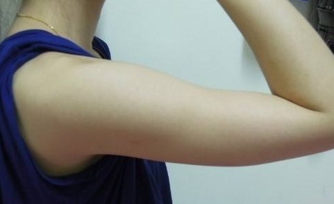 趙寅局拉皮：口碑何如？經(jīng)歷、擅長和用戶反饋來說話！