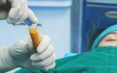 張嬌嬌鼻部整形效果驚艷，愛(ài)思特知名醫(yī)生分享案例美圖，讓我心動(dòng)！