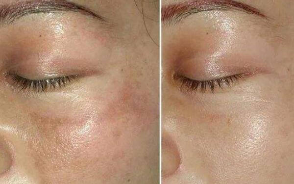 廣州領(lǐng)銜！全新發(fā)布隆鼻專家排行榜！盤點(diǎn)醫(yī)生資料！