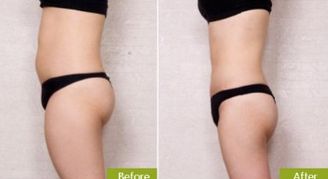 廣州雙眼皮手術(shù)哪家醫(yī)院好？專家推薦的地標(biāo)醫(yī)療機(jī)構(gòu)一覽