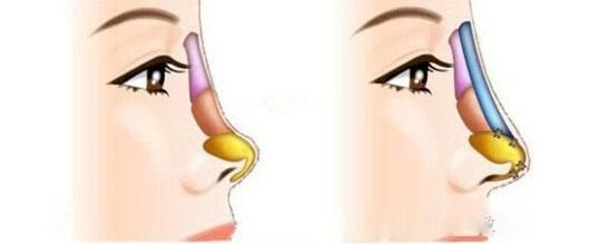 全國哪家醫(yī)院祛斑好？10家值得信賴的專業(yè)醫(yī)院推薦