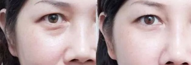 保定市整形外科哪家好？2023年最新榜單及專家推薦！